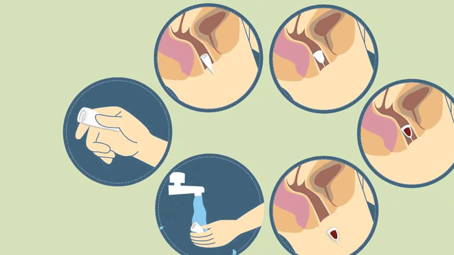 Điều kiện nhập khẩu cốc nguyệt san