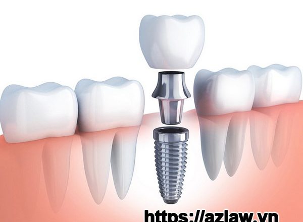 Giấy tờ cần thiết để nhập khẩu răng giả